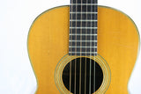 1964 Martin 00-21 New Yorker Acoustic Guitar! Brazilian Rosewood NY Model! Steel String!